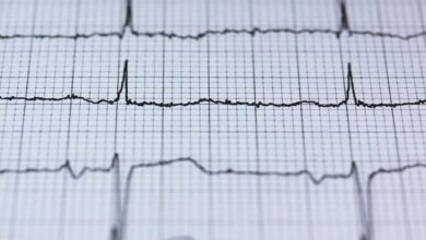 stellar apex beam pulse